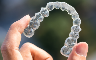 Clear Aligners/Invisalign: Transforming Smile Without Braces