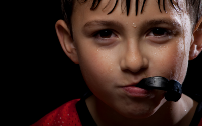 The Importance of Mouthguards in Protecting Your Smile