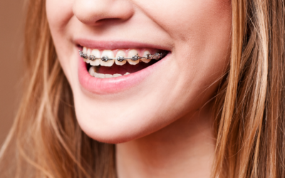Achieve a Perfect Smile with Braces at Emu Plains Family Dental