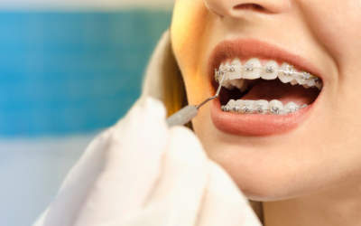 What to Expect During Your Orthodontic Treatment Journey 