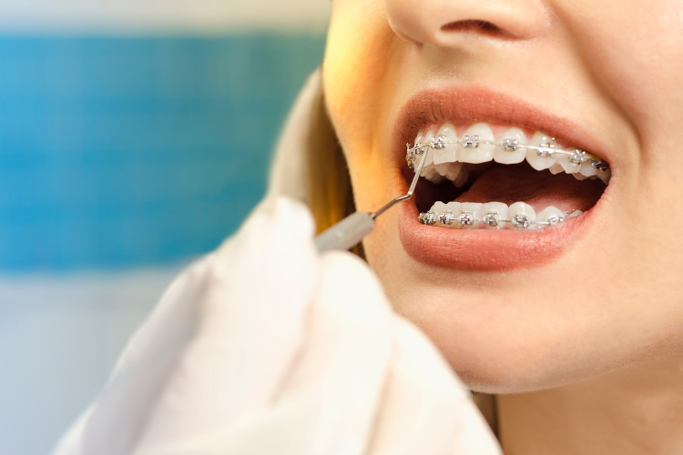 What to Expect During Your Orthodontic Treatment Journey 