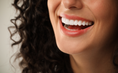 Veneers vs. Bonding: Which Cosmetic Solution Fits Your Smile Goals?