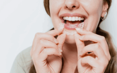 Top 10 Benefits of Clear Aligners for Straightening Your Smile