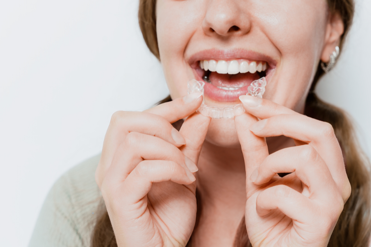 Top 10 Benefits of Clear Aligners for Straightening Your Smile