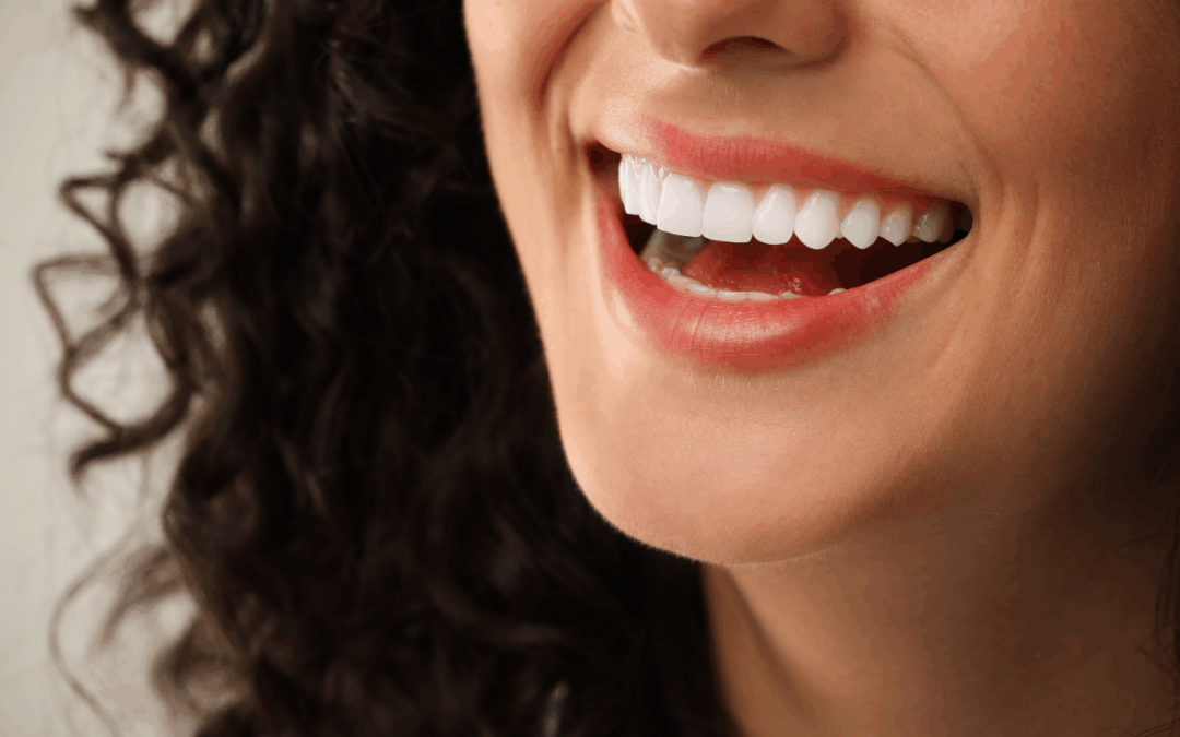Composite Veneers vs. Porcelain: Which One Should You Choose?