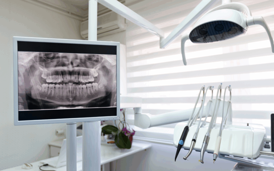 Understanding Dental X-Rays and Your Dental Health