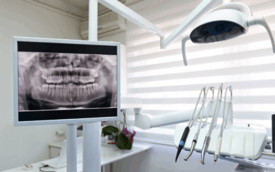 Understanding Dental X-Rays and Your Dental Health