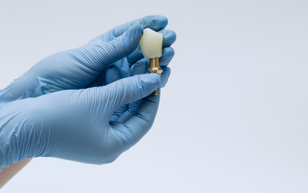 Everything You Need to Know About Implants