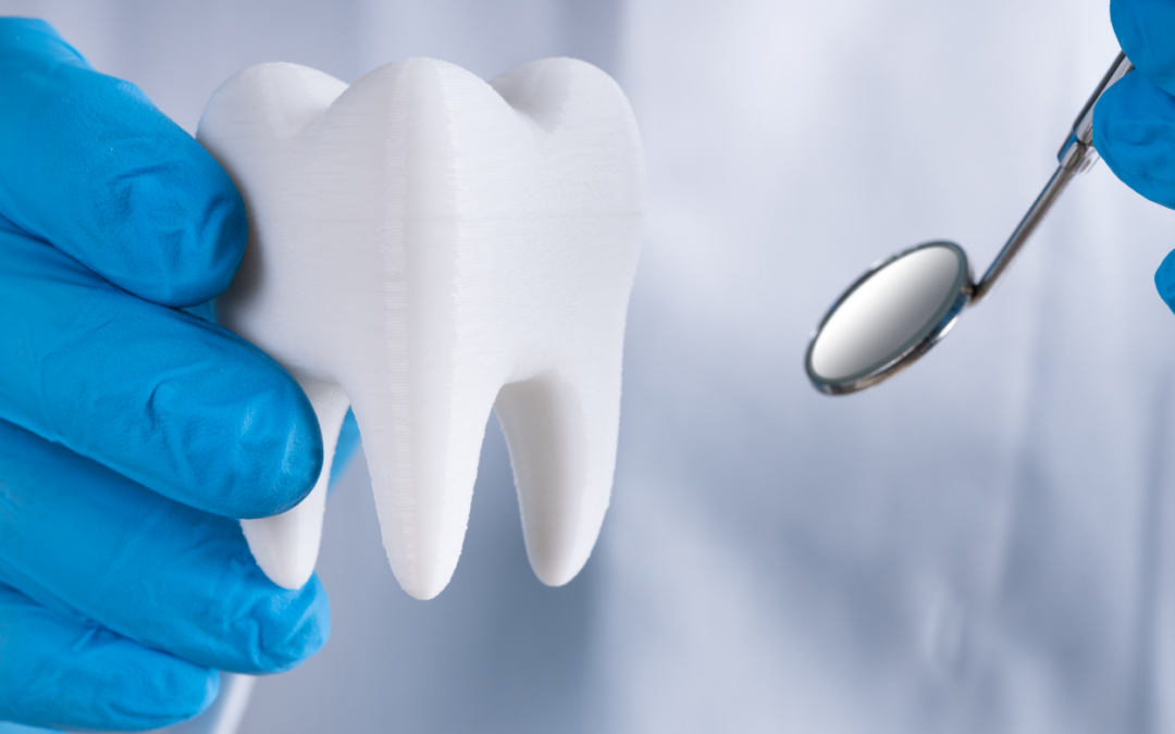 Everything You Need to Know About Tooth Replacement Options