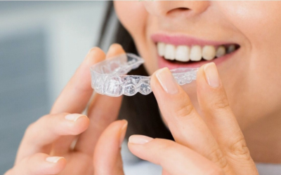 Does Invisalign Hurt? What Patients in Emu Plains Should Know
