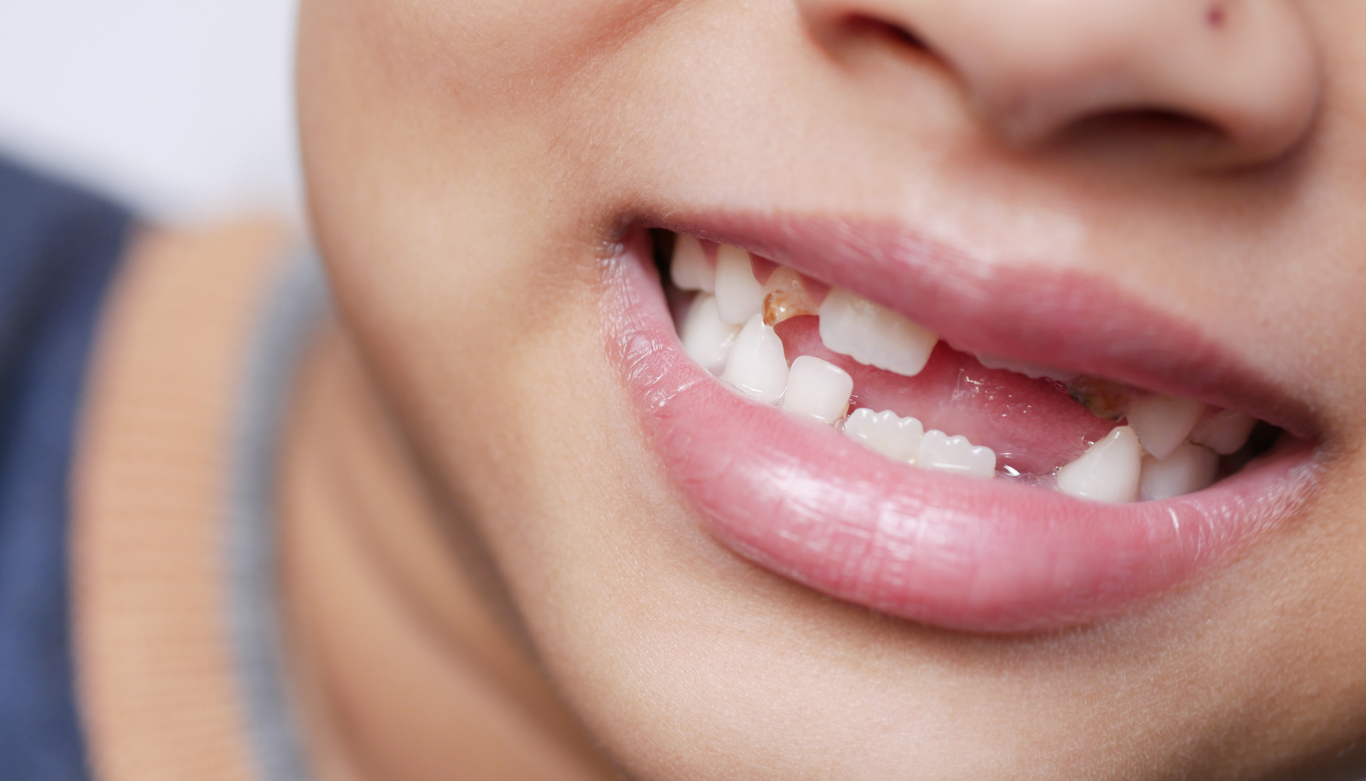 Copy of Dental Blog Images 12